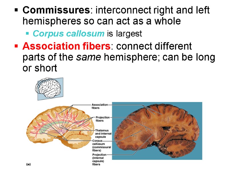 Commissures: interconnect right and left hemispheres so can act as a whole Corpus callosum